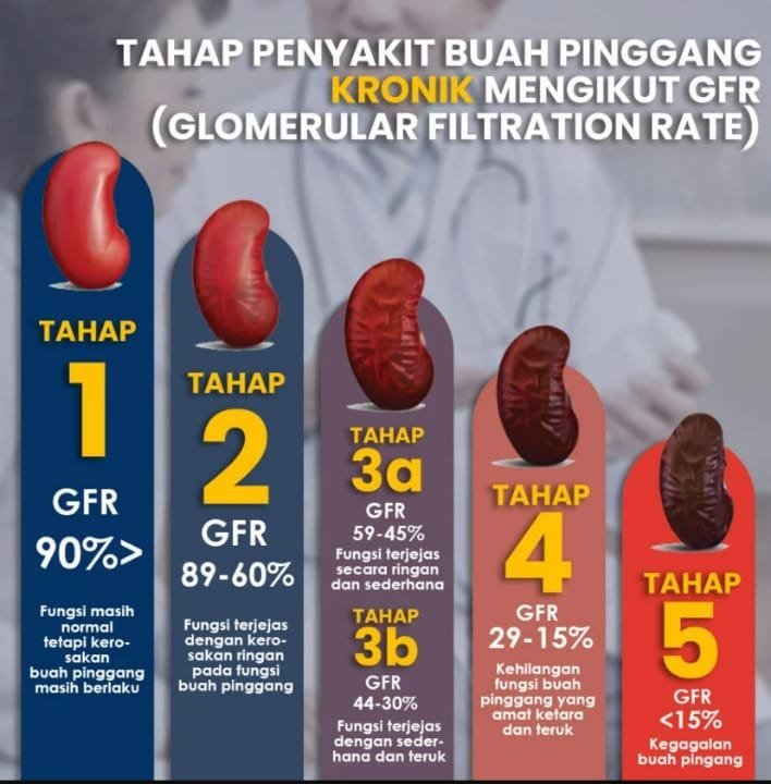 Tahap penyakit buah pinggang kronik mengikut GFR (Glomerular Filtration Rate), tahap 1 hingga 5